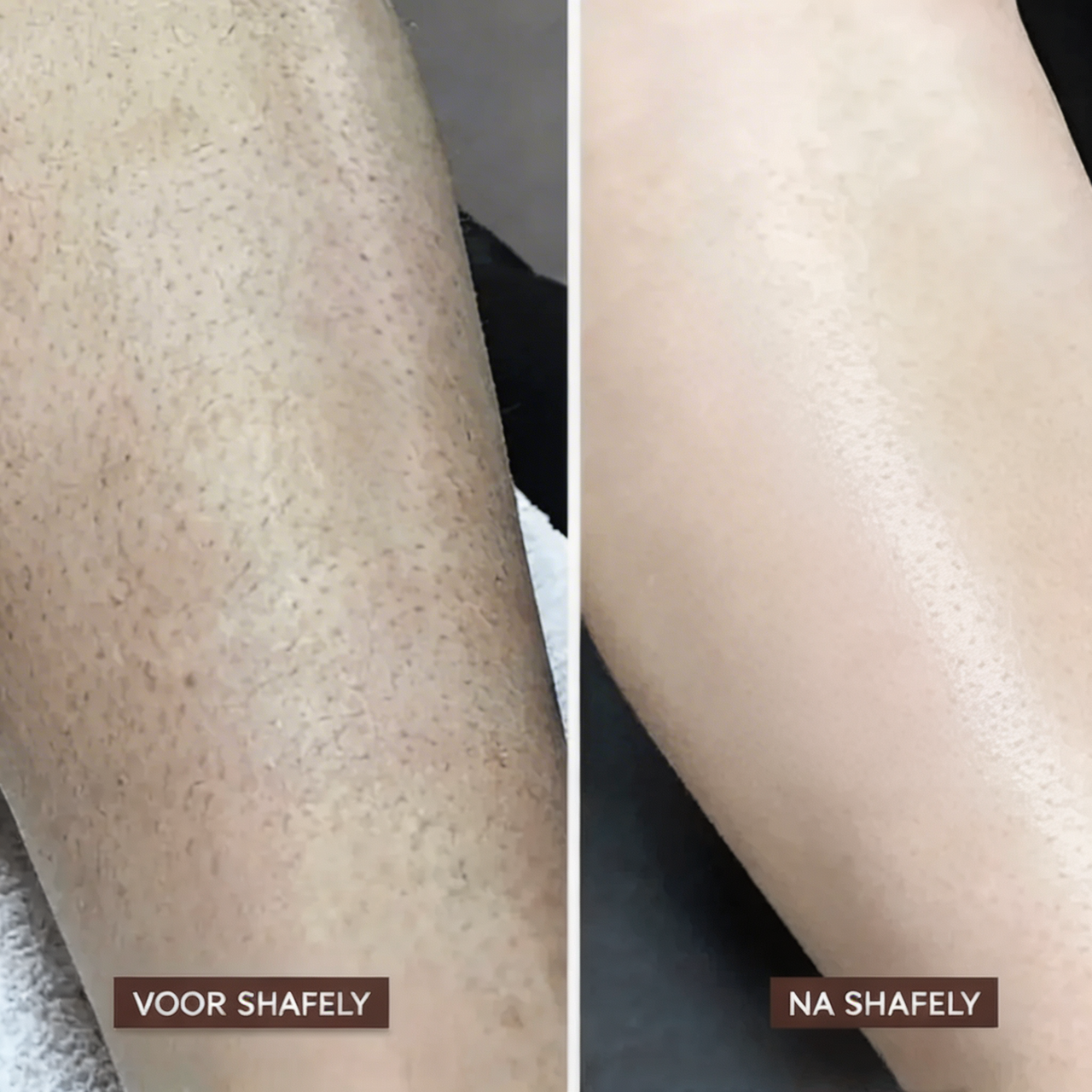 Shafely 2-in-1 Lichaamstrimmer voor Vrouwen