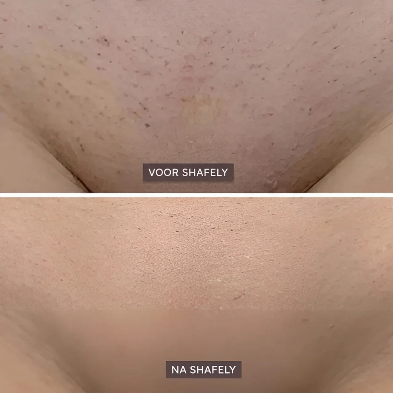 Shafely 2-in-1 Lichaamstrimmer voor Vrouwen