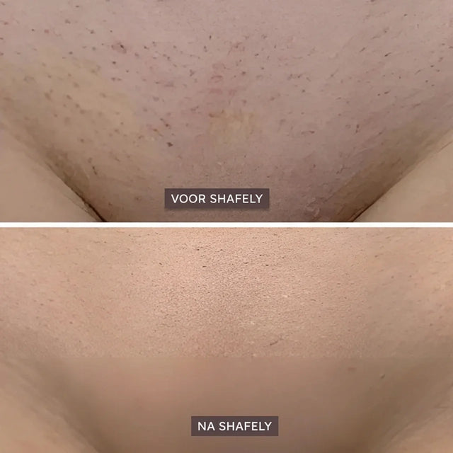 Shafely 2-in-1 Lichaamstrimmer voor Vrouwen
