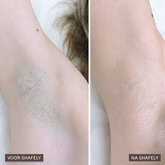 Shafely 2-in-1 Lichaamstrimmer voor Vrouwen